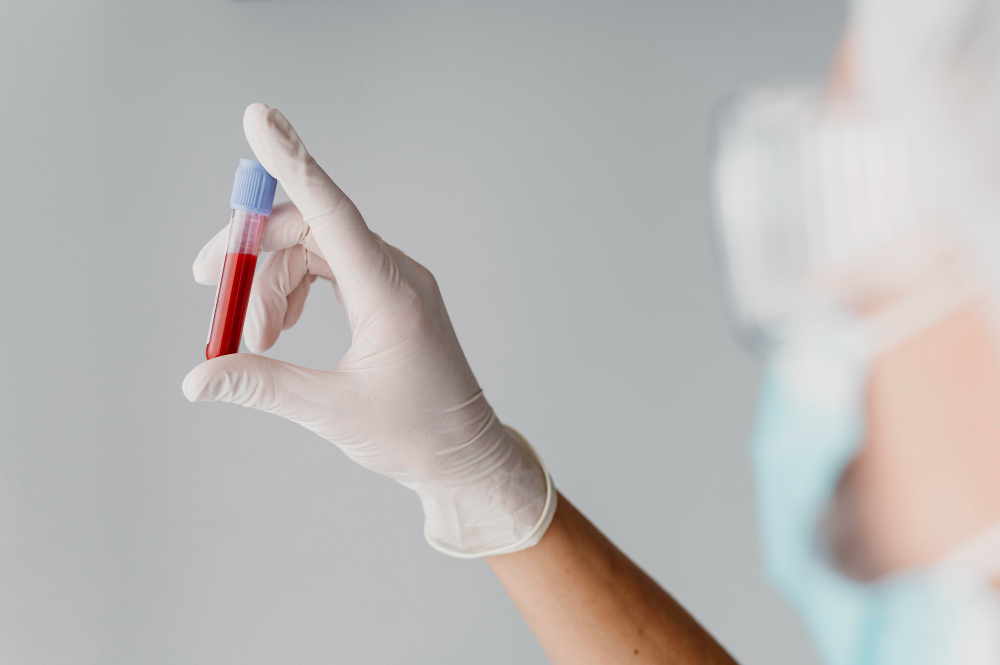 A importância dos exames de sangue: Saiba quais são os principais exames de sangue